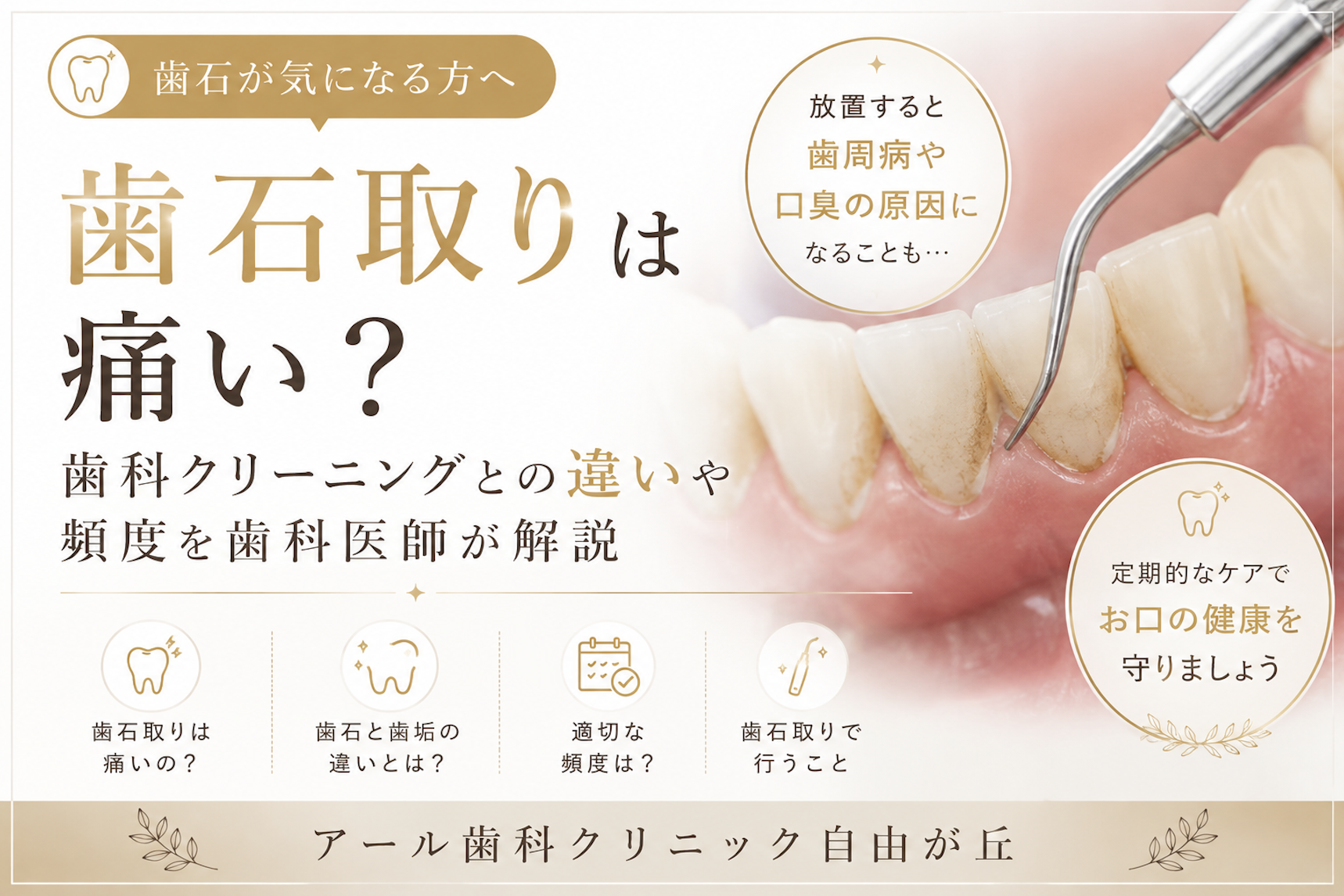 歯石取りは痛い？歯科クリーニングとの違いや頻度を歯科医師が解説