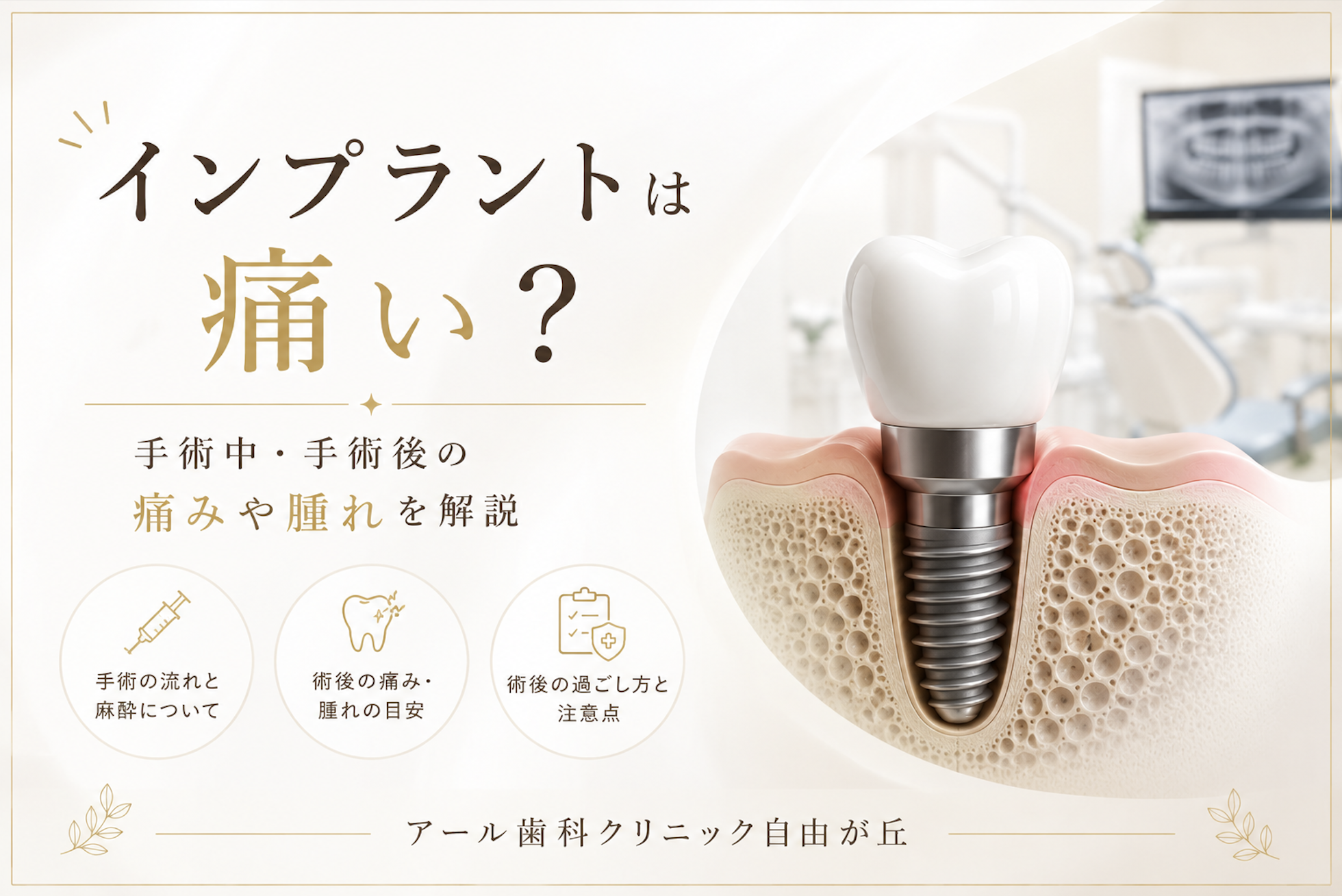 インプラントは痛い？手術中・手術後の痛みや腫れについて解説
