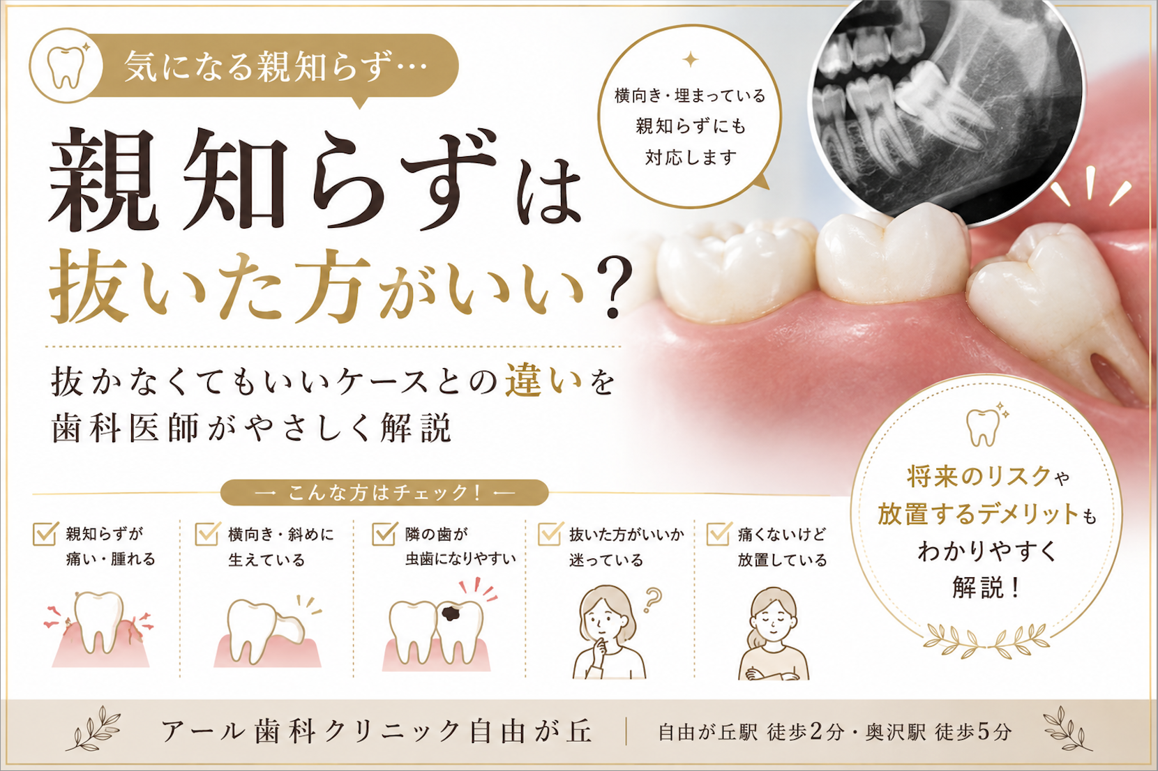 親知らずは抜いた方がいい？抜かなくてもいいケースとの違いを歯科医師が解説